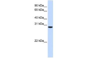 Western Blotting (WB) image for anti-Chromosome 18 Open Reading Frame 10 (C18orf10) antibody (ABIN2459873) (TPGS2 Antikörper)