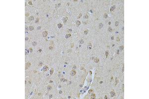 Immunohistochemistry of paraffin-embedded mouse brain using NME1 Antibody (ABIN5970089) at dilution of 1/200 (40x lens). (NME1 Antikörper  (C-Term))