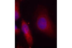 Immunofluorescence staining of methanol-fixed HeLa cells using Phospho-SRC-Y529 antibody (ABIN5969948). (Src Antikörper  (pTyr529))