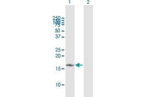 Western Blot analysis of PDRG1 expression in transfected 293T cell line by PDRG1 MaxPab polyclonal antibody. (PDRG1 Antikörper  (AA 1-133))