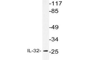 Western blot (WB) analyzes of IL-32 antibody in extracts from HepG2 cells. (IL32 Antikörper)
