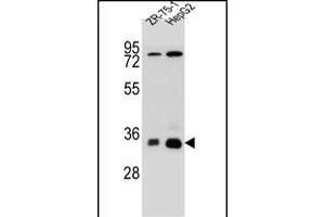 MTHFD2L Antibody (C-term) (ABIN655253 and ABIN2844851) western blot analysis in HepG2,ZR-75-1 cell line lysates (35 μg/lane). (MTHFD2L Antikörper  (C-Term))