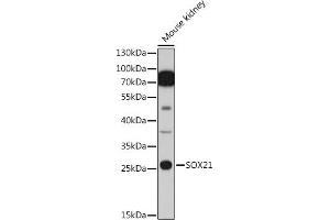 Western blot analysis of extracts of Mouse kidney cells, using SOX21 antibody (ABIN7270574) at 1:1000 dilution. (SOX21 Antikörper  (AA 167-276))