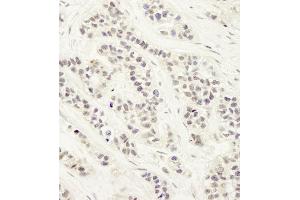 anti-DNA Cross-Link Repair 1C (DCLRE1C) (C-Term) antibody