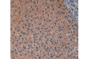 IHC-P analysis of Liver tissue, with DAB staining. (LAP Antikörper  (AA 320-519))