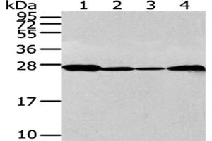 Gel: 12 % SDS-PAGE, Lysate: 40 μg, Lane 1-4: 293T, K562, Jurkat and 231 cell, Primary antibody: ABIN7128063(UCHL3 Antibody) at dilution 1/300 dilution, Secondary antibody: Goat anti rabbit IgG at 1/8000 dilution, Exposure time: 30 seconds (UCHL3 Antikörper)