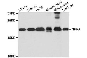 Western Blotting (WB) image for anti-Natriuretic Peptide A (NPPA) (AA 26-151) antibody (ABIN3022234)