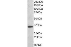 Western Blotting (WB) image for anti-Thioredoxin-Related Transmembrane Protein 1 (TMX1) (C-Term) antibody (ABIN2466410) (TMX1 Antikörper  (C-Term))
