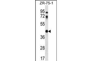 Western blot analysis in ZR-75-1 cell line lysates (35ug/lane). (CTSO Antikörper  (N-Term))