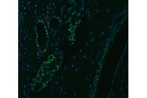 IF analysis of SNRPA1 using anti-SNRPA1 antibody (ABIN7599131). (SNRPA1 Antikörper  (AA 1-233))