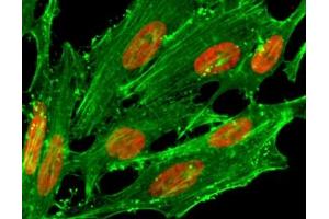 ICC/IF staining of HeLa cells treated with sodium butyrate using recombinant H2A. (Rekombinanter H2AFZ Antikörper  (acLys7))