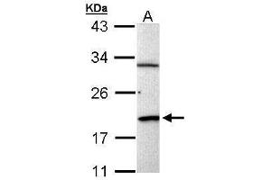WB Image Sample (30 ug of whole cell lysate) A: Raji 12% SDS PAGE antibody diluted at 1:1000 (BCL2-Like 15 Antikörper)