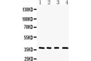 anti-Cytochrome C Oxidase Subunit I (COX1) (AA 2-14), (N-Term) antibody