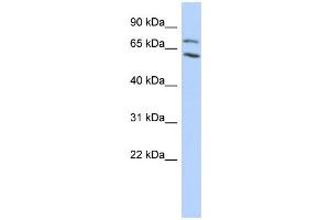 WB Suggested Anti-MTA2 Antibody Titration:  0. (MTA2 Antikörper  (N-Term))