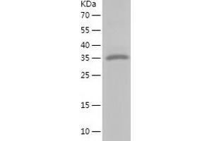 Western Blotting (WB) image for Calponin 1 (CNN1) (AA 1-297) protein (His tag) (ABIN7122105)