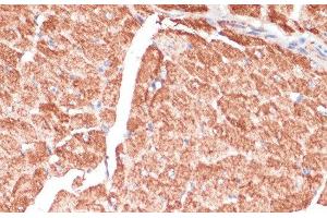 Immunohistochemistry of paraffin-embedded Mouse heart using DES Polyclonal Antibody at dilution of 1:100 (40x lens). (Desmin Antikörper)