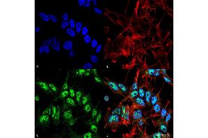 Immunocytochemistry/Immunofluorescence analysis using Rabbit Anti-Beclin 1 Polyclonal Antibody . (Beclin 1 Antikörper)