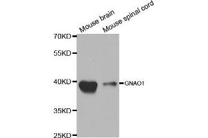 Western blot analysis of extracts of various cell lines, using GNAO1 antibody. (GNAO1 Antikörper  (AA 60-180))