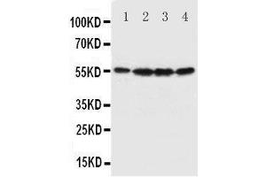 Western Blotting (WB) image for anti-Fascin (FSCN1) (AA 97-113), (N-Term) antibody (ABIN3044444)