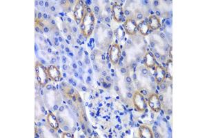 Immunohistochemistry of paraffin-embedded mouse kidney using MATK antibody. (MATK Antikörper)