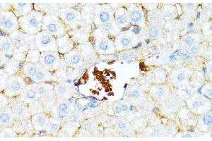 Immunohistochemistry of paraffin-embedded Mouse liver using SPTA1 Polyclonal Antibody at dilution of 1:100 (40x lens).