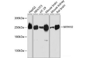 Western blot analysis of extracts of various cell lines using MYH10 Polyclonal Antibody at dilution of 1:3000. (MYH10 Antikörper)