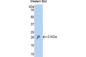 Western blot analysis of the recombinant protein. (CFP Antikörper  (AA 310-459))