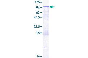 Transglutaminase 2 Protein (AA 1-548) (GST tag)