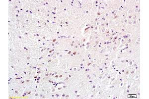 Formalin-fixed and paraffin embedded rat brain labeled with Anti-BS69/Adenovirus 5 E1A binding protein Polyclonal Antibody, Unconjugated (ABIN872692) at 1:200 followed by conjugation to the secondary antibody and DAB staining. (ZMYND11 Antikörper  (AA 501-602))