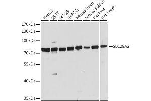 Western blot analysis of extracts of various cell lines, using SLC28 antibody (ABIN7270447) at 1:1000 dilution.