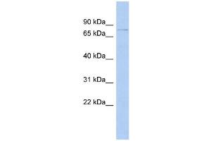 WB Suggested Anti-DHX58 Antibody Titration:  0. (DHX58 Antikörper  (N-Term))