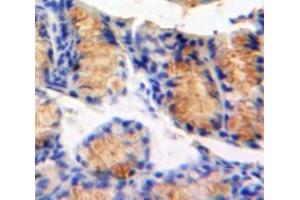 IHC-P analysis of Bowels tissue, with DAB staining. (MAP4K5 Antikörper  (AA 9-231))