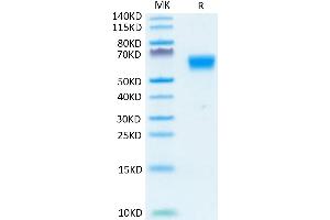 Human TGF-beta RII on Tris-Bis PAGE under reduced condition. (TGFBR2 Protein (AA 24-159) (mFc-Avi Tag))