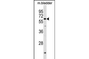 PGM2L1 Antibody (C-term) (ABIN1537400 and ABIN2849741) western blot analysis in mouse bladder tissue lysates (35 μg/lane). (PGM2L1 Antikörper  (C-Term))