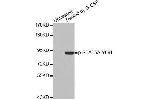 Western Blotting (WB) image for anti-Signal Transducer and Activator of Transcription 5A (STAT5A) (pTyr694) antibody (ABIN1870647) (STAT5A Antikörper  (pTyr694))