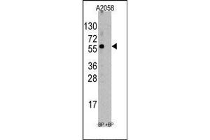 Image no. 1 for anti-Suppression of Tumorigenicity 13 (ST13) (N-Term) antibody (ABIN358737)