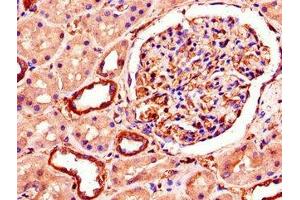 Immunohistochemistry of paraffin-embedded human kidney tissue using ABIN7151222 at dilution of 1:100 (SMURF1 Antikörper  (AA 198-374))