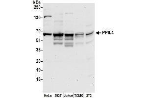 Western Blotting (WB) image for anti-Peptidylprolyl Isomerase (Cyclophilin)-Like 4 (PPIL4) (AA 325-375) antibody (ABIN7450590)