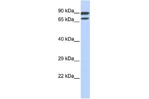 WB Suggested Anti-ZNF583 Antibody Titration:  0. (ZNF583 Antikörper  (N-Term))