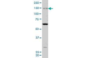 MYO3A monoclonal antibody (M08A), clone 8H2 Western Blot analysis of MYO3A expression in Hela S3 NE . (MYO3A Antikörper  (AA 1400-1490))