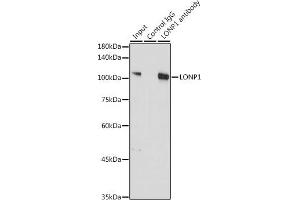 Immunoprecipitation analysis of 300 μg extracts of A-549 cells using 3 μg LONP1 antibody (ABIN1680707, ABIN3018785, ABIN3018786 and ABIN6220576). (LONP1 Antikörper  (AA 120-400))