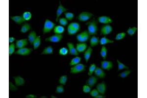 Immunofluorescence staining of Hela cells with ABIN7175695 at 1:66, counter-stained with DAPI. (WDFY2 Antikörper  (AA 2-114))