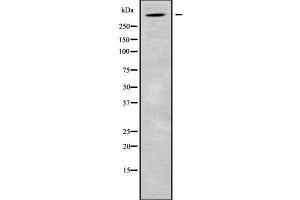 Western blot analysis of ALMS1 using HeLa whole cell lysates (ALMS1 Antikörper  (C-Term))