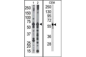 Image no. 1 for anti-6-phosphofructo-2-Kinase/fructose-2,6-Biphosphatase 3 (PFKFB3) (C-Term) antibody (ABIN360653) (PFKFB3 Antikörper  (C-Term))