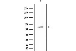Western blot analysis of lysates from Mouse testis, using Chk2 Mouse Monoclonal Antibody at 1/1000 dilution.
