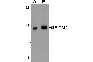 Western Blotting (WB) image for anti-Interferon-Induced Transmembrane Protein 1 (IFITM1) (Middle Region) antibody (ABIN1030951)