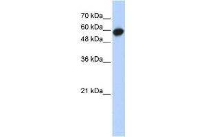Western Blotting (WB) image for anti-Leucine Rich Repeat Containing 6 (LRRC6) antibody (ABIN2459700) (LRRC6 Antikörper)