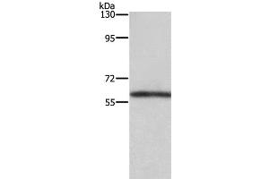 Western Blot analysis of Mouse kidney tissue using TBX5 Polyclonal Antibody at dilution of 1:350 (T-Box 5 Antikörper)