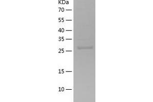 Western Blotting (WB) image for Pim-1 Oncogene (PIM1) (AA 38-290) protein (His tag) (ABIN7124452)