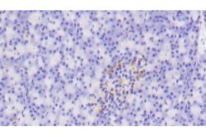 Detection of TLR5 in Human Pancreas Tissue using Polyclonal Antibody to Toll Like Receptor 5 (TLR5) (TLR5 Antikörper  (AA 303-514))